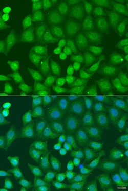 Invitrogen ZFYVE16 Polyclonal Antibody 100 &mu;L; Unconjugated:Antibodies,