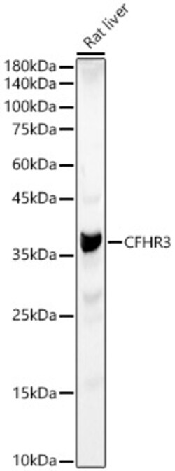 Invitrogen CFHR3 Polyclonal Antibody 100 &mu;L; Unconjugated:Antibodies,