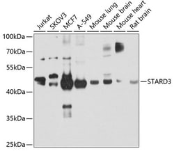 Invitrogen STARD3 Polyclonal Antibody 100 &mu;L; Unconjugated:Antibodies,