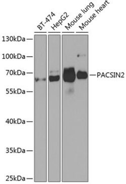 PACSIN2 Polyclonal Antibody, Invitrogen 100 &mu;L; Unconjugated:Antibodies,