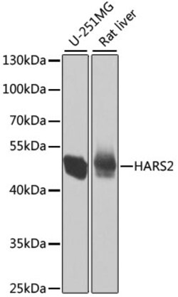 HARS2 Polyclonal Antibody 100 &mu;L | Buy Online | Invitrogen | Fisher Scientific