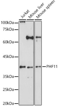 Invitrogen PHF11 Polyclonal Antibody 100 &mu;L; Unconjugated:Antibodies,