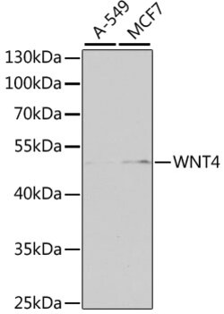 Invitrogen WNT4 Polyclonal Antibody 100 &mu;L; Unconjugated:Antibodies,