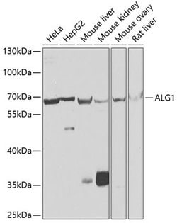 ALG1 Polyclonal Antibody, Invitrogen 100 &mu;L; Unconjugated:Antibodies,