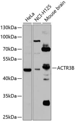 Invitrogen ACTR3B Polyclonal Antibody 100 &mu;L; Unconjugated:Antibodies,