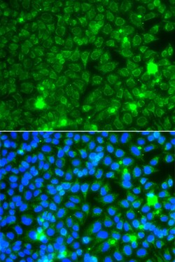 Invitrogen GBA3 Polyclonal Antibody 100 &mu;L; Unconjugated:Antibodies,