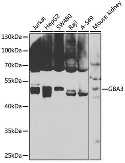 Invitrogen GBA3 Polyclonal Antibody 100 &mu;L; Unconjugated:Antibodies,
