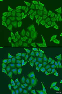 Invitrogen HICE1 Polyclonal Antibody 100 &mu;L; Unconjugated:Antibodies,