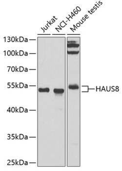 Invitrogen HICE1 Polyclonal Antibody 100 &mu;L; Unconjugated:Antibodies,