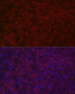 Invitrogen LRG1 Polyclonal Antibody 100 &mu;L; Unconjugated:Antibodies,