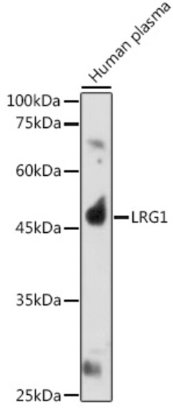 Invitrogen LRG1 Polyclonal Antibody 100 &mu;L; Unconjugated:Antibodies,