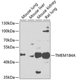 Invitrogen TMEM184A Polyclonal Antibody 100 &mu;L; Unconjugated:Antibodies,