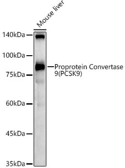 Invitrogen PCSK9 Polyclonal Antibody 100 &mu;L; Unconjugated:Antibodies,