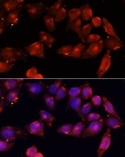 ACVR2B Polyclonal Antibody, Invitrogen 100 &mu;L; Unconjugated:Antibodies,