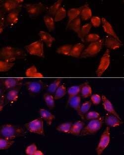 ACVR2B Polyclonal Antibody, Invitrogen 100 &mu;L; Unconjugated:Antibodies,