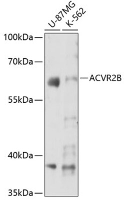 ACVR2B Polyclonal Antibody, Invitrogen 100 &mu;L; Unconjugated:Antibodies,