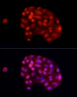 Invitrogen ADAR Polyclonal Antibody 100 &mu;L; Unconjugated:Antibodies,