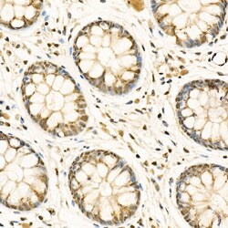 Invitrogen ADAR Polyclonal Antibody 100 &mu;L; Unconjugated:Antibodies,
