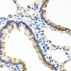 Angiopoietin 1 Polyclonal Antibody, Invitrogen 100 &mu;L; Unconjugated:Antibodies,