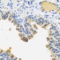 Angiopoietin 1 Polyclonal Antibody, Invitrogen 100 &mu;L; Unconjugated:Antibodies,