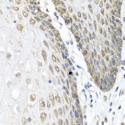 Angiopoietin 1 Polyclonal Antibody, Invitrogen 100 &mu;L; Unconjugated:Antibodies,
