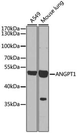 Angiopoietin 1 Polyclonal Antibody, Invitrogen 100 &mu;L; Unconjugated:Antibodies,