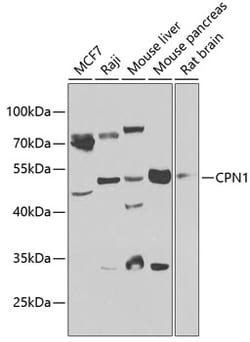 CPN1 Polyclonal Antibody:Antibodies, Polyclonal
