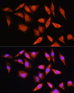 Invitrogen HSPA2 Polyclonal Antibody 100 &mu;L; Unconjugated:Antibodies,