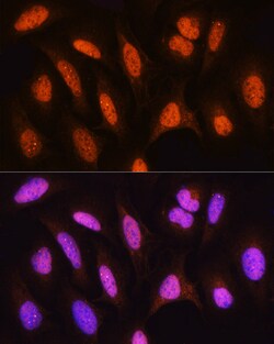 Invitrogen HSPA2 Polyclonal Antibody 100 &mu;L; Unconjugated:Antibodies,