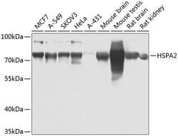 Invitrogen HSPA2 Polyclonal Antibody 100 &mu;L; Unconjugated:Antibodies,