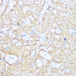 Invitrogen CD56 Polyclonal Antibody 100 &mu;L; Unconjugated:Antibodies,