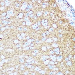 Invitrogen CD56 Polyclonal Antibody 100 &mu;L; Unconjugated:Antibodies,