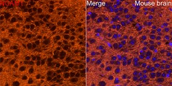 Invitrogen CD56 Polyclonal Antibody 100 &mu;L; Unconjugated:Antibodies,