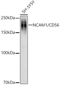 Invitrogen CD56 Polyclonal Antibody 100 &mu;L; Unconjugated:Antibodies,