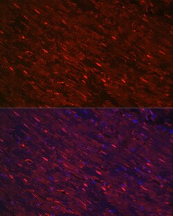 Invitrogen PGAM2 Polyclonal Antibody 100 &mu;L; Unconjugated:Antibodies,