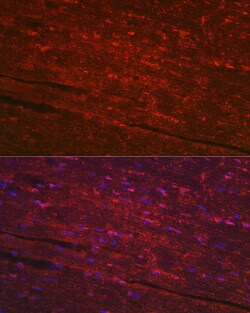 Invitrogen PGAM2 Polyclonal Antibody 100 &mu;L; Unconjugated:Antibodies,