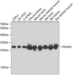 Invitrogen PGAM2 Polyclonal Antibody 100 &mu;L; Unconjugated:Antibodies,
