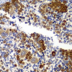 Invitrogen AMPK beta-1 Polyclonal Antibody 100 &mu;L; Unconjugated:Antibodies,