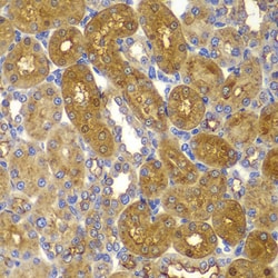 Invitrogen AMPK beta-1 Polyclonal Antibody 100 &mu;L; Unconjugated:Antibodies,