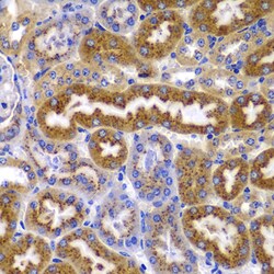 Invitrogen AMPK beta-1 Polyclonal Antibody 100 &mu;L; Unconjugated:Antibodies,