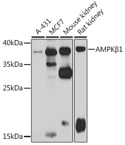 Invitrogen AMPK beta-1 Polyclonal Antibody 100 &mu;L; Unconjugated:Antibodies,
