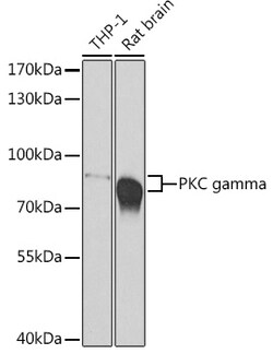 Invitrogen PKC gamma Polyclonal Antibody 100 &mu;L | Buy Online | Invitrogen&trade; | Fisher Scientific