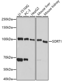 Invitrogen Sortilin Polyclonal Antibody 100 &mu;L; Unconjugated:Antibodies,
