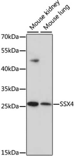 Invitrogen SSX4 Polyclonal Antibody 100 &mu;L; Unconjugated:Antibodies,