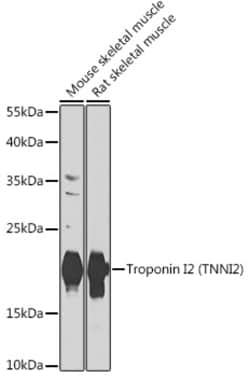 Invitrogen TNNI2 Polyclonal Antibody 100 &mu;L | Buy Online | Invitrogen&trade; | Fisher Scientific
