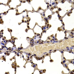 Invitrogen NSD2 Polyclonal Antibody 100 &mu;L; Unconjugated:Antibodies,