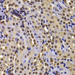 Invitrogen NSD2 Polyclonal Antibody 100 &mu;L; Unconjugated:Antibodies,