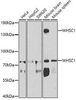 Invitrogen NSD2 Polyclonal Antibody 100 &mu;L; Unconjugated:Antibodies,