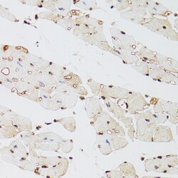 Invitrogen JMJD2A Polyclonal Antibody 100 &mu;L | Buy Online | Invitrogen&trade; | Fisher Scientific