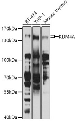 Invitrogen JMJD2A Polyclonal Antibody 100 &mu;L | Buy Online | Invitrogen&trade; | Fisher Scientific